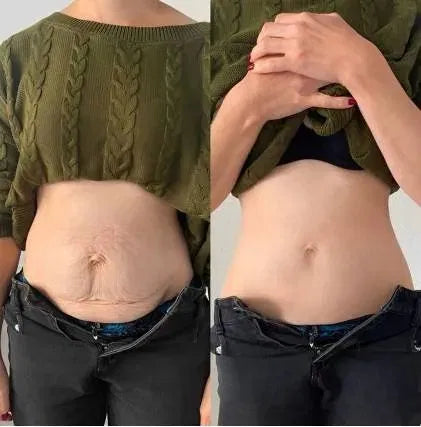 Faja Reductora Avispa