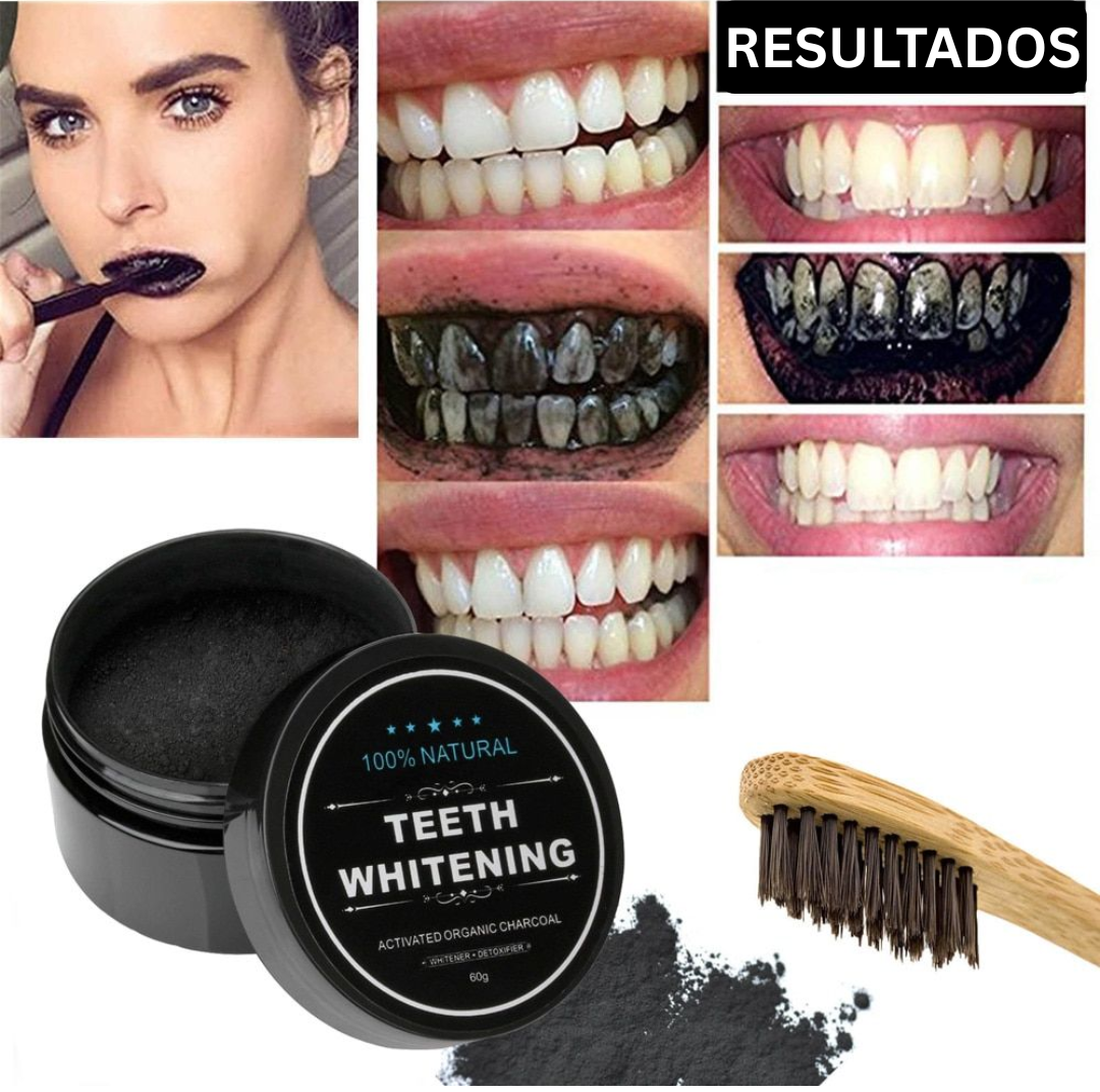 Blanqueamiento Dental ORGÁNICO